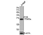 CD3 Antibody in Western Blot (WB)
