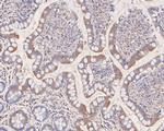 EDG2 Recombinant Rabbit Monoclonal Antibody (JE60-07)
