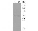 FHL1 Recombinant Rabbit Monoclonal Antibody (JE40-35)