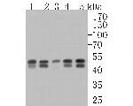 PTPN2 Recombinant Rabbit Monoclonal Antibody (JE57-07)