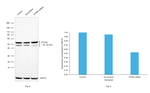 PTPN2 Antibody in Western Blot (WB)