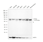PTPN2 Recombinant Rabbit Monoclonal Antibody (JE57-07)