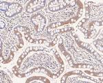NKp44 Recombinant Rabbit Monoclonal Antibody (JE61-04)