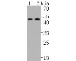 NKp44 Recombinant Rabbit Monoclonal Antibody (JE61-04)