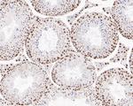 SR Antibody in Immunohistochemistry (Paraffin) (IHC (P))