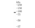 PPM1E Recombinant Rabbit Monoclonal Antibody (JE61-81)