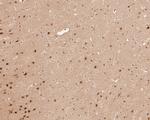 DCAF7 Antibody in Immunohistochemistry (Paraffin) (IHC (P))