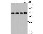 DCAF7 Antibody in Western Blot (WB)