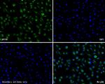 NPY5R Recombinant Rabbit Monoclonal Antibody (JE61-56)