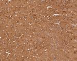 NPY5R Antibody in Immunohistochemistry (Paraffin) (IHC (P))