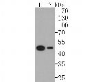 ELP4 Recombinant Rabbit Monoclonal Antibody (JE61-03)