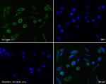 Collagen III Recombinant Rabbit Monoclonal Antibody (JE60-79)