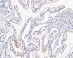 GBP1 Recombinant Rabbit Monoclonal Antibody (JE60-78)