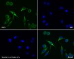 FDFT1 Recombinant Rabbit Monoclonal Antibody (JE60-69)