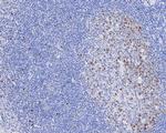 CDCA5 Antibody in Immunohistochemistry (Paraffin) (IHC (P))