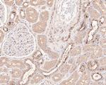 IL11RA Antibody in Immunohistochemistry (Paraffin) (IHC (P))