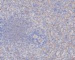 CD84 Recombinant Rabbit Monoclonal Antibody (JE59-27)