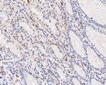 PDCD7 Recombinant Rabbit Monoclonal Antibody (JE59-06)