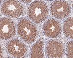 Tug Antibody in Immunohistochemistry (Paraffin) (IHC (P))