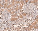 RCL Antibody in Immunohistochemistry (Paraffin) (IHC (P))