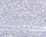 CPSF3 Recombinant Rabbit Monoclonal Antibody (JE59-11)