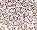 BRMS1 Antibody in Immunohistochemistry (Paraffin) (IHC (P))