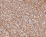BRMS1 Antibody in Immunohistochemistry (Paraffin) (IHC (P))