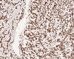 BRMS1 Antibody in Immunohistochemistry (Paraffin) (IHC (P))