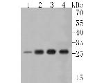 UPP1 Recombinant Rabbit Monoclonal Antibody (JE56-62)