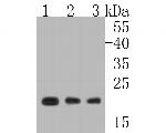 NCS1 Recombinant Rabbit Monoclonal Antibody (JE56-39)