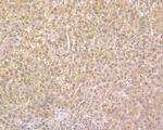 NUDT5 Recombinant Rabbit Monoclonal Antibody (JE56-41)