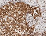 CHD3 Antibody in Immunohistochemistry (Paraffin) (IHC (P))