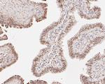CHD3 Antibody in Immunohistochemistry (Paraffin) (IHC (P))