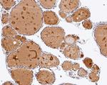 CHD3 Antibody in Immunohistochemistry (Paraffin) (IHC (P))