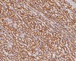 SUOX Recombinant Rabbit Monoclonal Antibody (JE56-74)