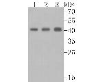 ACAA2 Antibody in Western Blot (WB)
