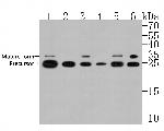 CTR1 Recombinant Rabbit Monoclonal Antibody (JE56-93)