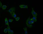 UBE4A Antibody in Immunocytochemistry (ICC/IF)