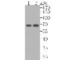 IGF2BP2 Recombinant Rabbit Monoclonal Antibody (JE56-58)
