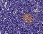 GNAS Antibody in Immunohistochemistry (Paraffin) (IHC (P))