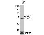 ACSL3 Monoclonal Antibody (A8F6)