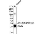 Lambda light chain Antibody in Western Blot (WB)