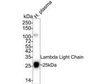 Lambda light chain Antibody in Western Blot (WB)