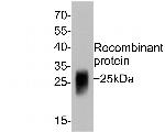 GM-CSF Monoclonal Antibody (A6C5)
