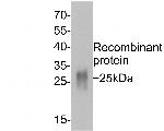 GM-CSF Monoclonal Antibody (A6C6)