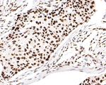 H3K18ac Antibody in Immunohistochemistry (Paraffin) (IHC (P))