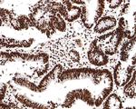 H3K18ac Antibody in Immunohistochemistry (Paraffin) (IHC (P))