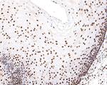 H3K18ac Antibody in Immunohistochemistry (Paraffin) (IHC (P))