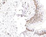 H3K18ac Antibody in Immunohistochemistry (Paraffin) (IHC (P))