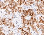 TROP2 Antibody in Immunohistochemistry (Paraffin) (IHC (P))